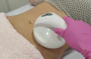 Corpo e Forma Estética Avançada: Transforme seu corpo com a Intradermoterapia