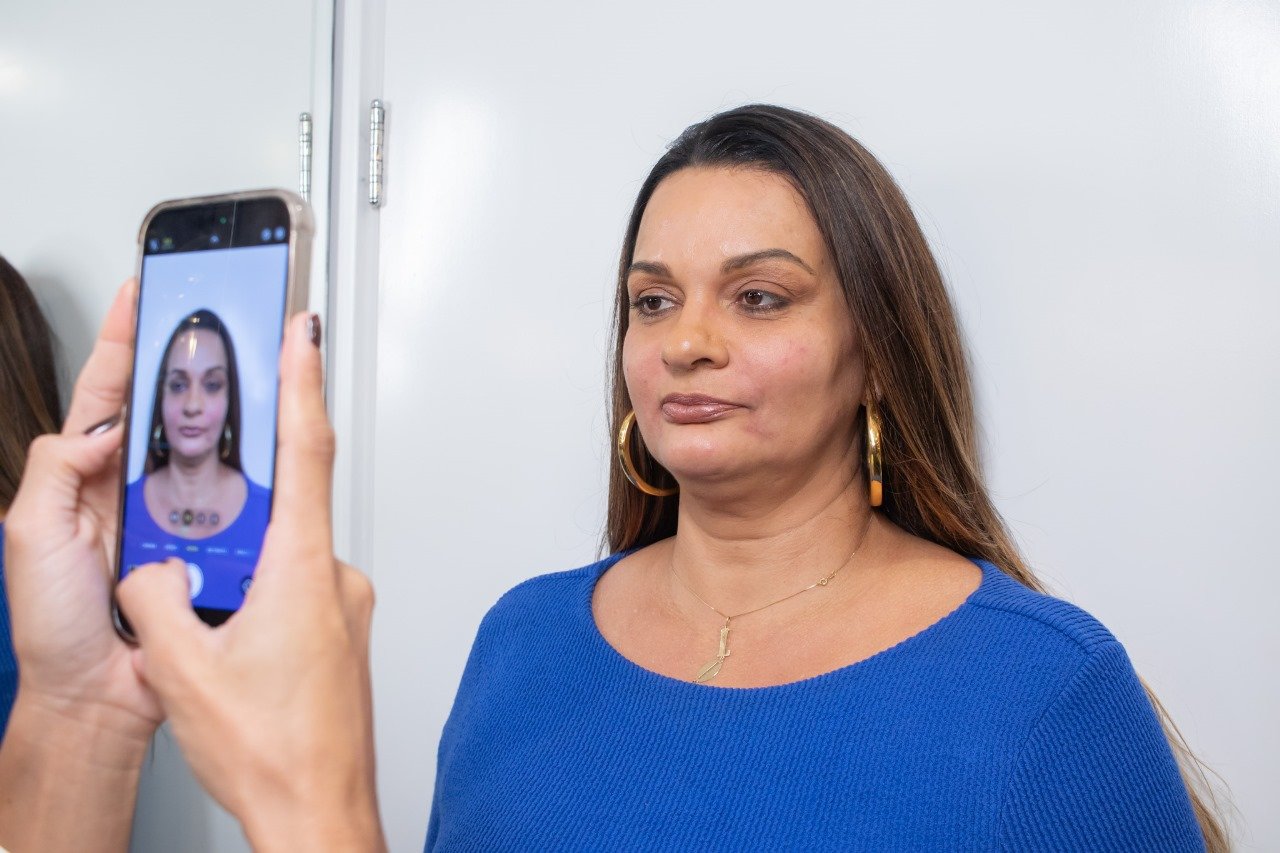 Madrinha de Bateria da Tatuapé, Carmen Reis, faz tratamento com botox para rejuvenescer pele "Vaidosa" 8 WhatsApp Image 2024 06 21 at 16.23.41
