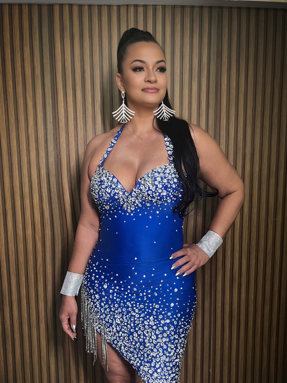 Madrinha de Bateria da Tatuapé, Carmen Reis, faz tratamento com botox para rejuvenescer pele "Vaidosa" 11 WhatsApp Image 2024 06 21 at 16.23.42 1