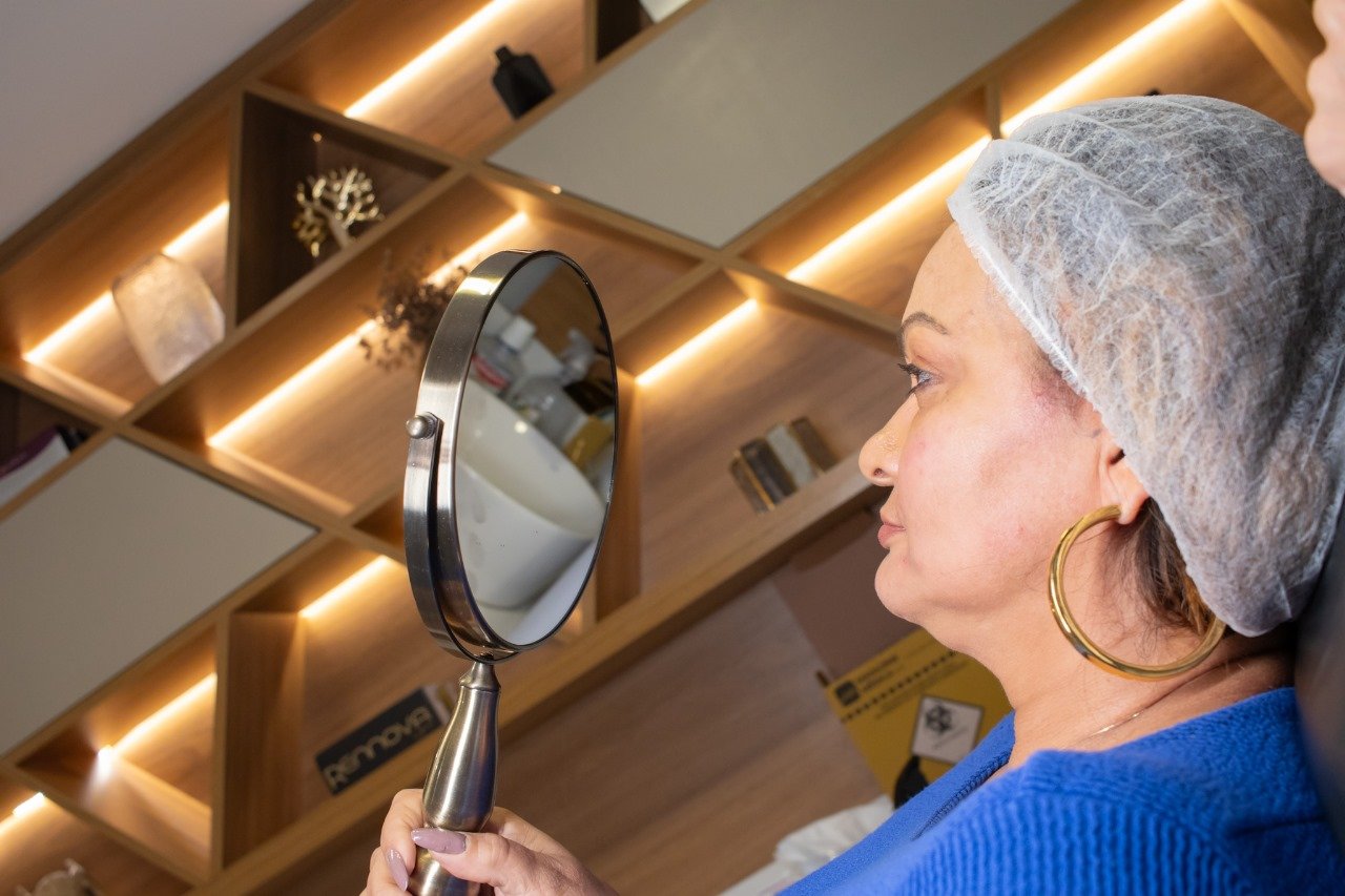 Madrinha de Bateria da Tatuapé, Carmen Reis, faz tratamento com botox para rejuvenescer pele Madrinha de Bateria da Tatuapé, Carmen Reis, faz tratamento com botox para rejuvenescer pele