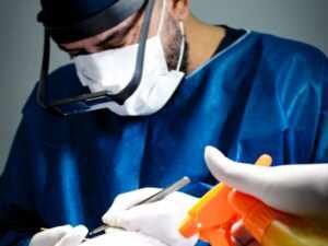 Dr. Miguel Matteo: Solução completa para a saúde do couro cabeludo na Clínica Dermattos