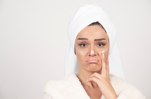 Desvendando o Melasma: Causas, tratamento e como recuperar a uniformidade da sua pele