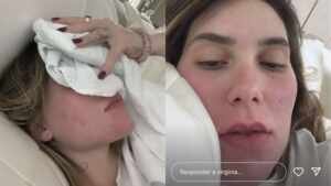 Virginia Fonseca revela abstinência ao iniciar novo tratamento de saude