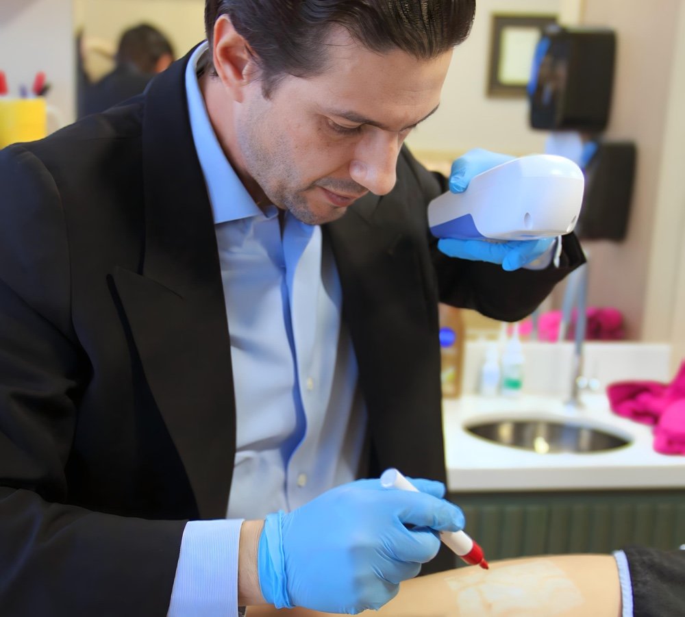 O Impacto do Verão na Saúde Vascular: Cuidados Essenciais com Varizes e Vasos Desanexadas