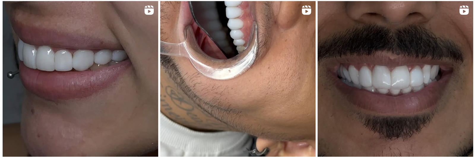 Dr. Edu Freitas: O Dentista que combina estilo e excelência em saúde bucal 26 Captura de Tela 2024 12 27 as 13.18.44