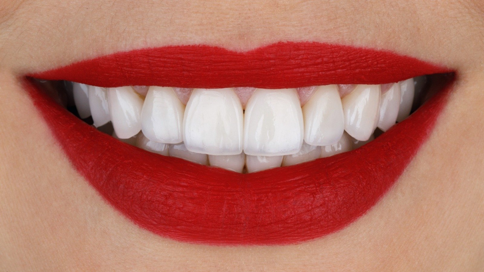 As lentes de contato dental podem corrigir qualquer problema estético? As lentes de contato dental podem corrigir qualquer problema estético?