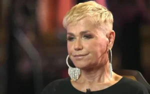 Xuxa Meneghel revela resultado de transplante capilar e descarta volta aos fios longos