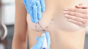 Dr. Octavio Curi Frascareli – Cirurgia da mulher moderna: a jovem mãe que se cuida