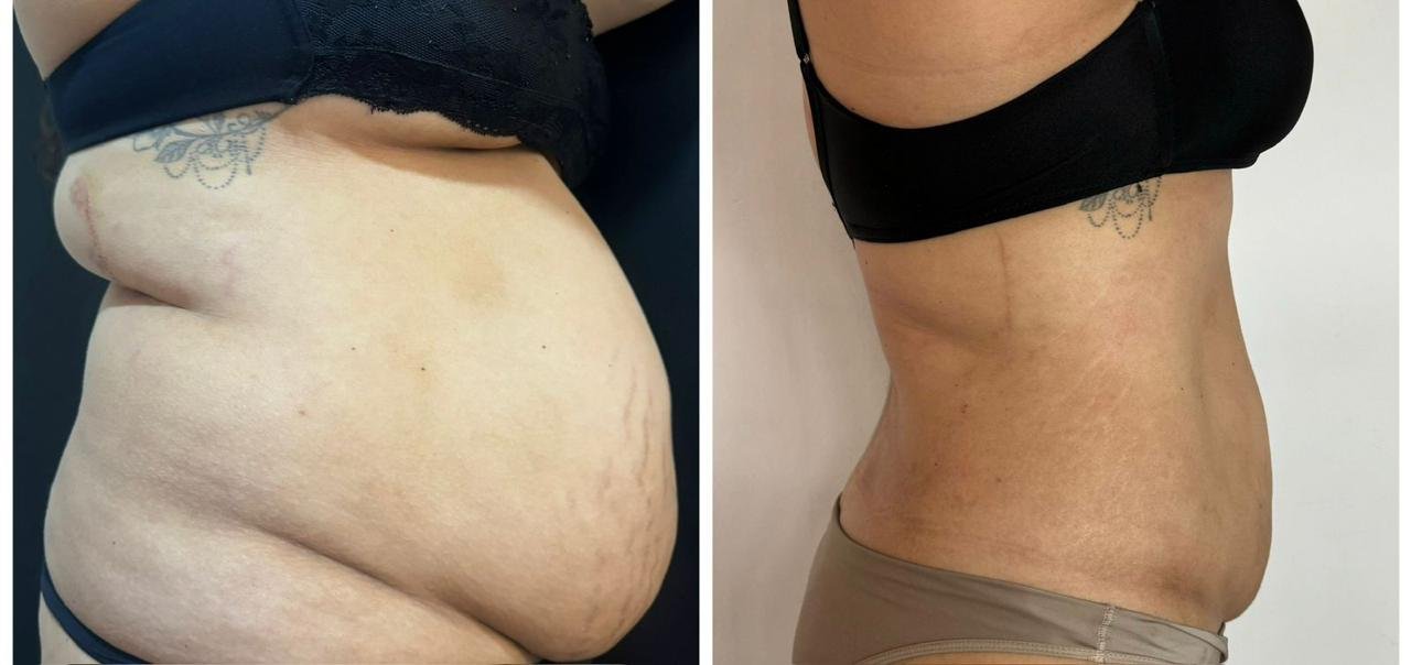 Gabrielle Souza transforma experiência clínica em método e mentoria na estética corporal 29 5d860076 f199 43cf 9454 ce96e524103f