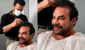 Felipe Duram escolhe o Dr. Pablo Milhomem para novo transplante capilar